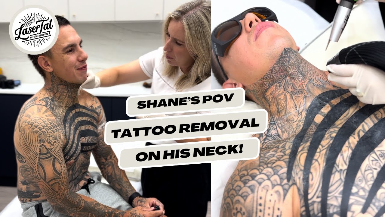 Client's POV of why he his removing his neck tattoo