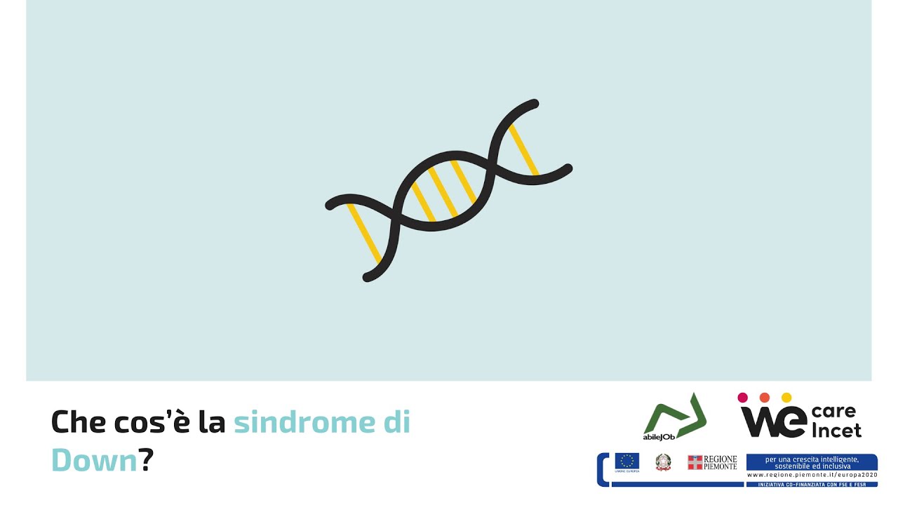 Che cos&rsquo;&egrave; la sindrome di Down?