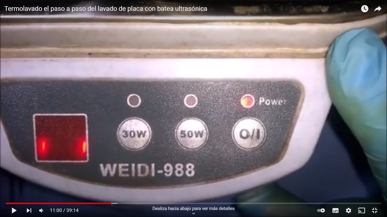 Termolavado el paso a paso del lavado de placa con batea ultrasónica