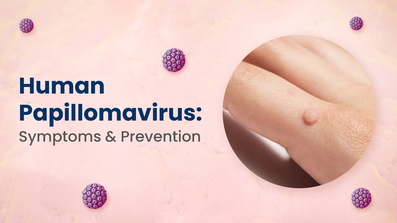 Symptoms of HPV in Men and Women | HPV Vaccine: Does It Work? | MFine