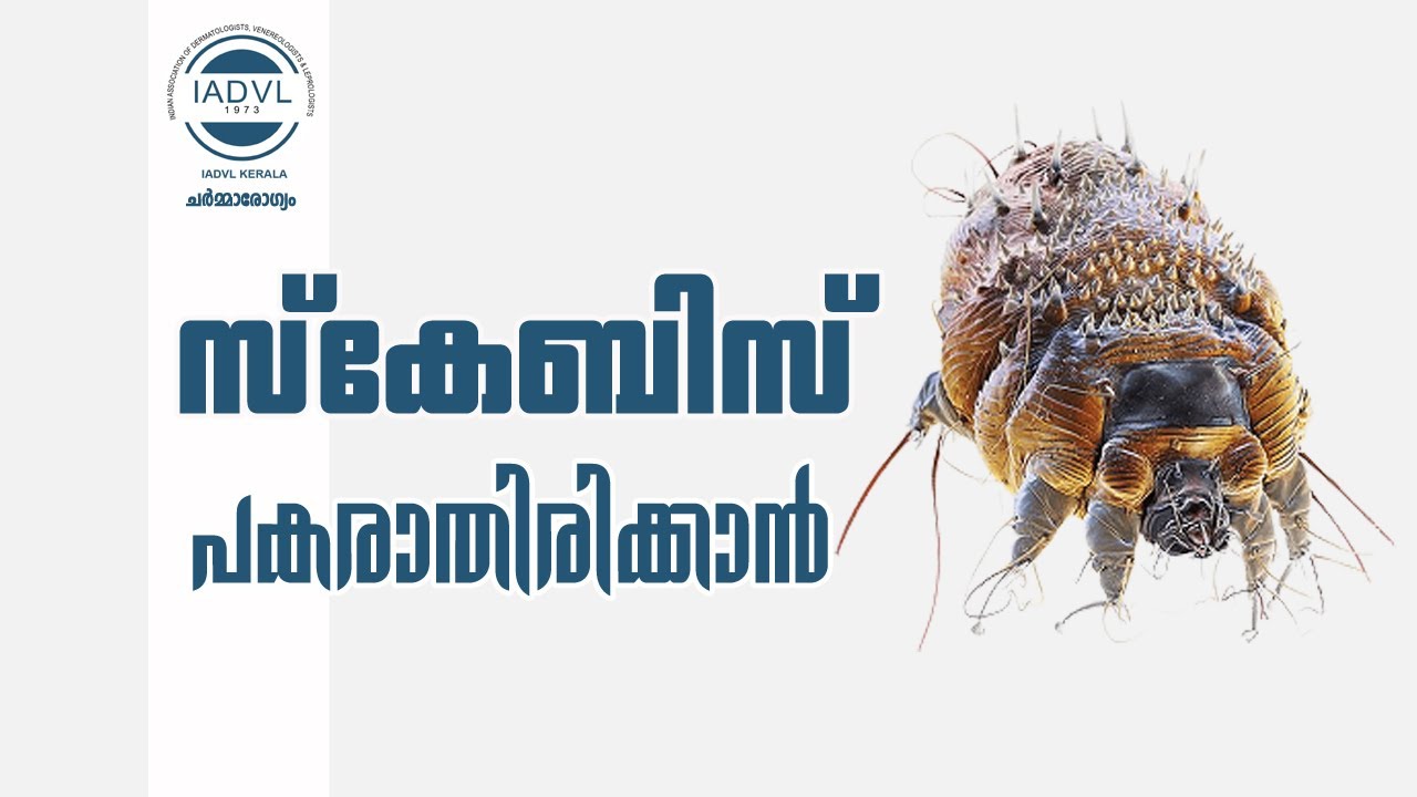 Scabies- how to prevent spread.സ്കേബിസ് - പകരാതിരിക്കാൻ