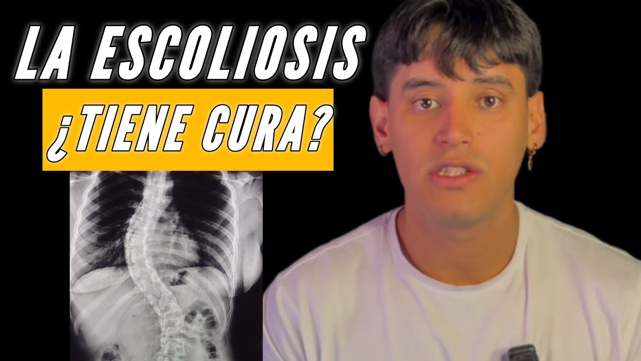 ESCOLIOSIS🩻 ¿QUÉ ES? ¿CÓMO SE CLASIFICA? ¿TIENE CURA? 