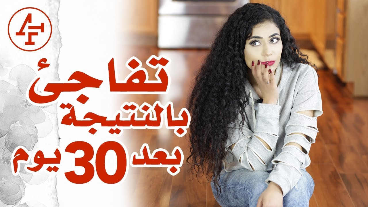 علاج اثار حب الشباب والحروق بدون اي وصفة - How to Get Rid of Scars