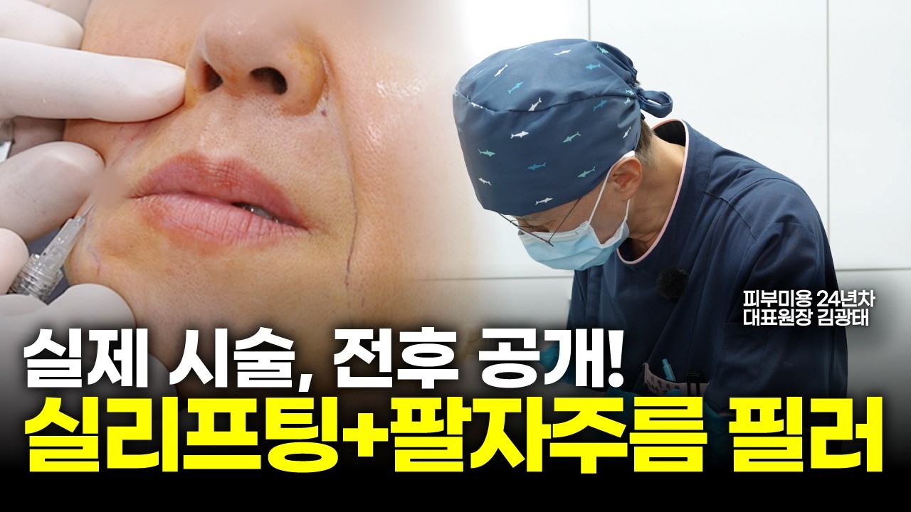 50대 팔자주름, 필러+실리프팅 시술 전 과정 공개!