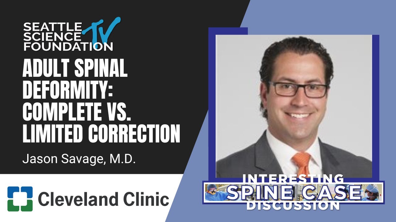 Adult Spinal Deformity: Complete vs. Limited Correction - Jason Savage, MD