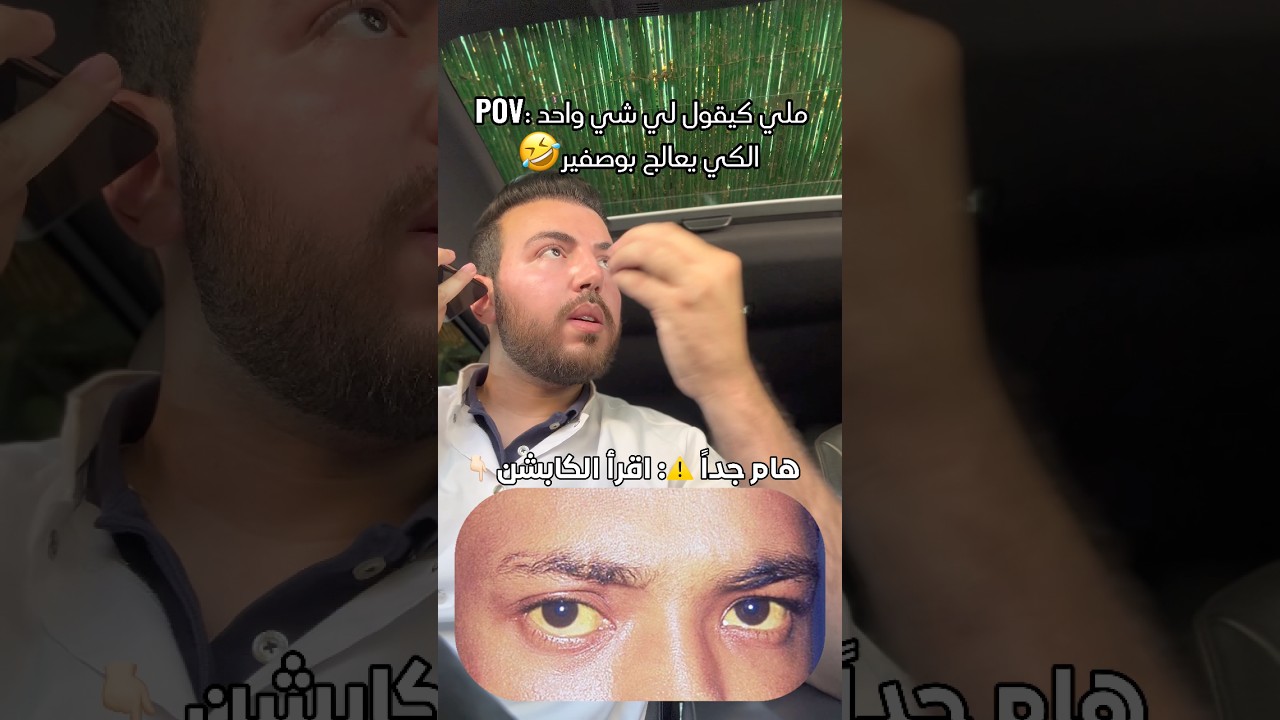إشاعة الكي و بوصفير (اقرأ الوصف 👇🏻)