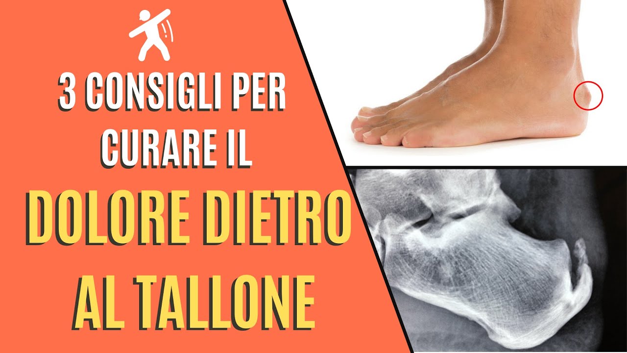 Dolore dietro al Tallone |  3 consigli pratici