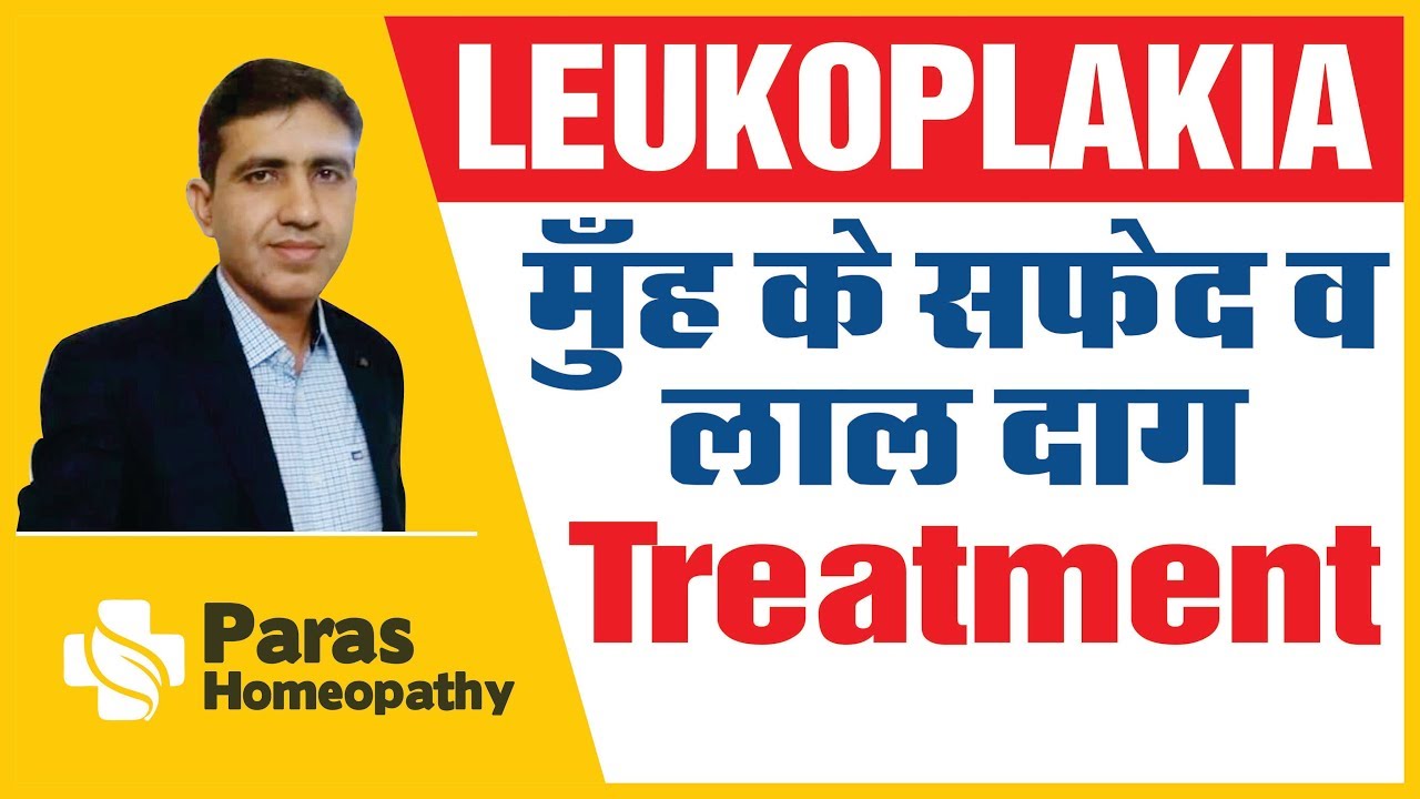 Leukoplakia | मुँह के सफ़ेद व लाल दाग | Leukoplakia Homeopathic Treatment