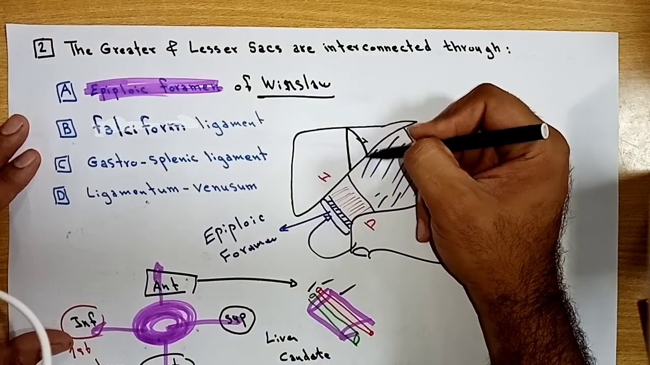 Abdomen, MCQs for Revision، Part I By Ahmed Belhaj