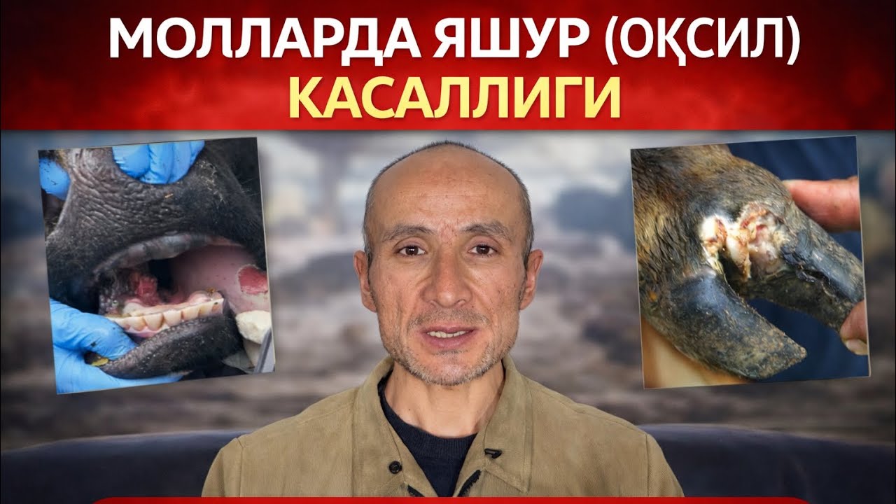 МОЛЛАРДА ЯШУР ( ОҚСИЛ ) КАСАЛЛИГИ ВА УНИ ДАВОЛАШ ЧОРАЛАРИ БУНИ ЗУДЛИК БИЛАН КЎРИНГ