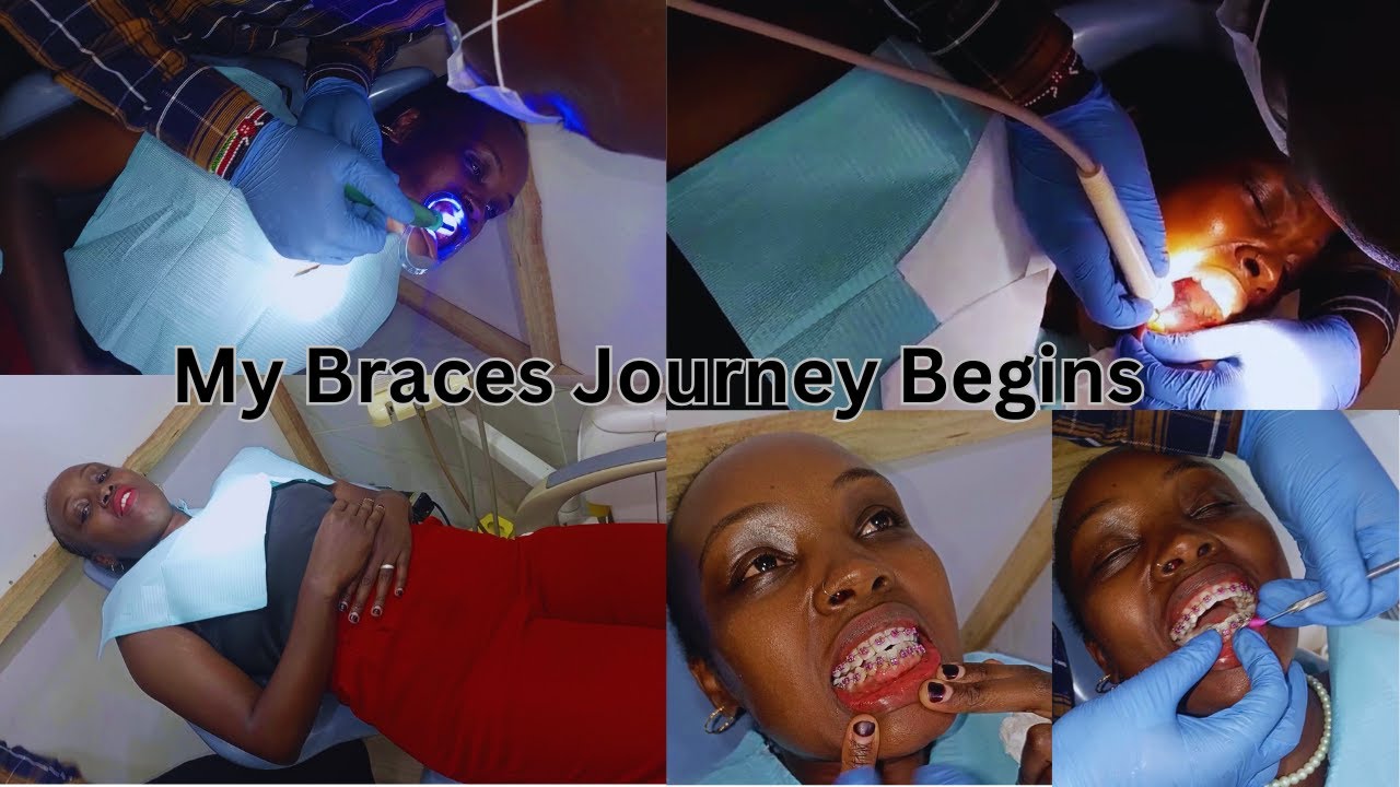 Nairobi living\my journey with braces begins\fixing my smile\spend the day with me as i get braces
