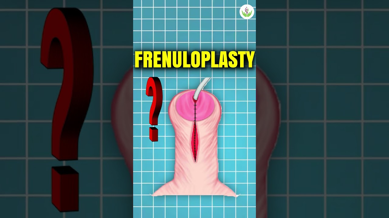 Tight Foreskin Fixed Safely with ZSR | Frenuloplasty Explained | Care Well  Medical Centre