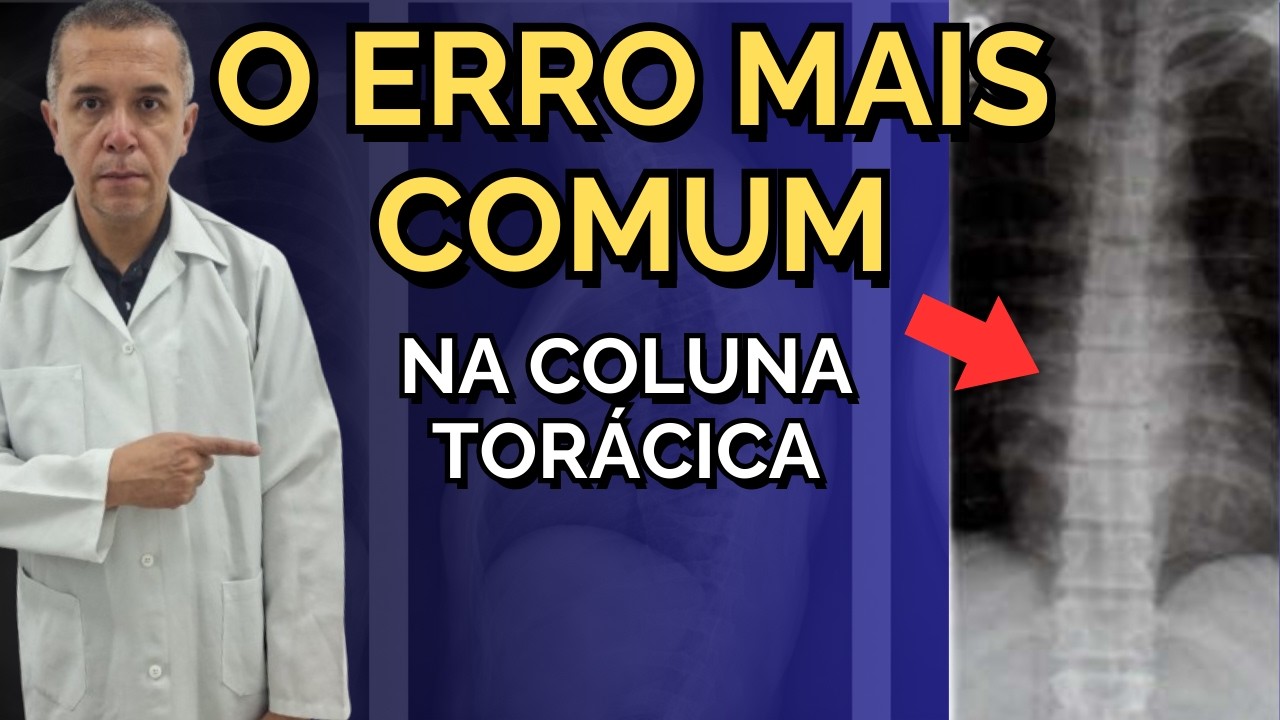 Posicionamento Radiográfico da Coluna Torácica