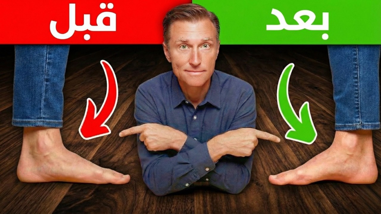 أقوى تمرين لعلاج القدم المنسطحة نهائياا