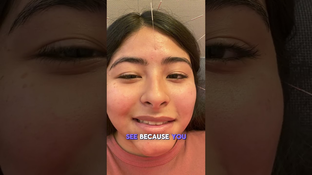 Bell’s Palsy Recovery — Wendy’s Story