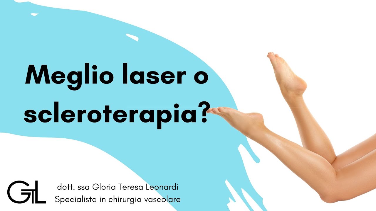 Meglio sclerosanti o laser?