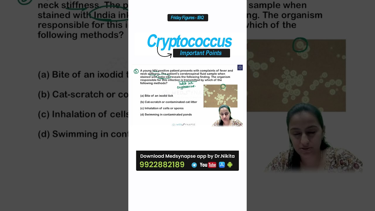 Cryptococcus high yield points for Neetpg/inicet/fmge | Microbiology