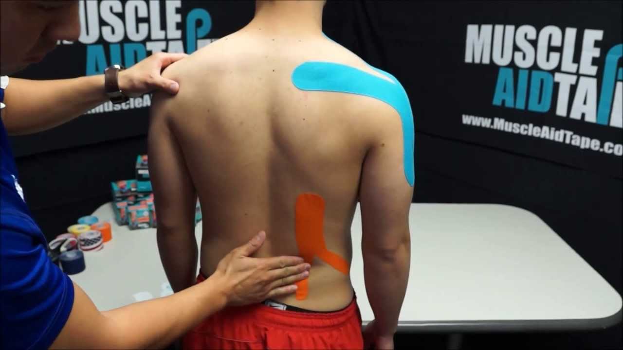 MuscleAidTape: Limited Range of Motion in Shoulders