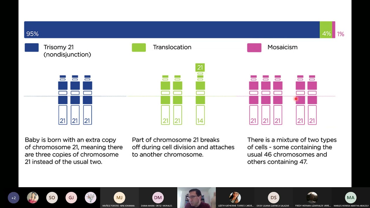 Síndromes de Down, X Frágil y Alcoholismo Fetal