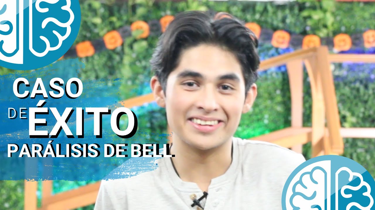 👏CASO DE ÉXITO😉 TESTIMONIO PARÁLISIS DE BELL - Recuperación, tratamiento, ejercicios de Fisioterapia