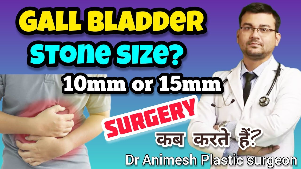 Gall bladder stone कितना बड़ा होने पर surgery करा लेनी चाहिए?किस size के stone में medicine देते है?