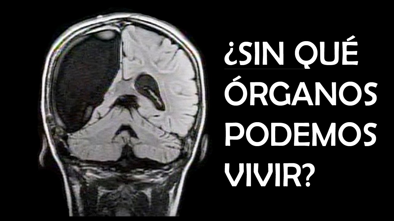 ¿SIN QUÉ ÓRGANOS PODEMOS VIVIR?
