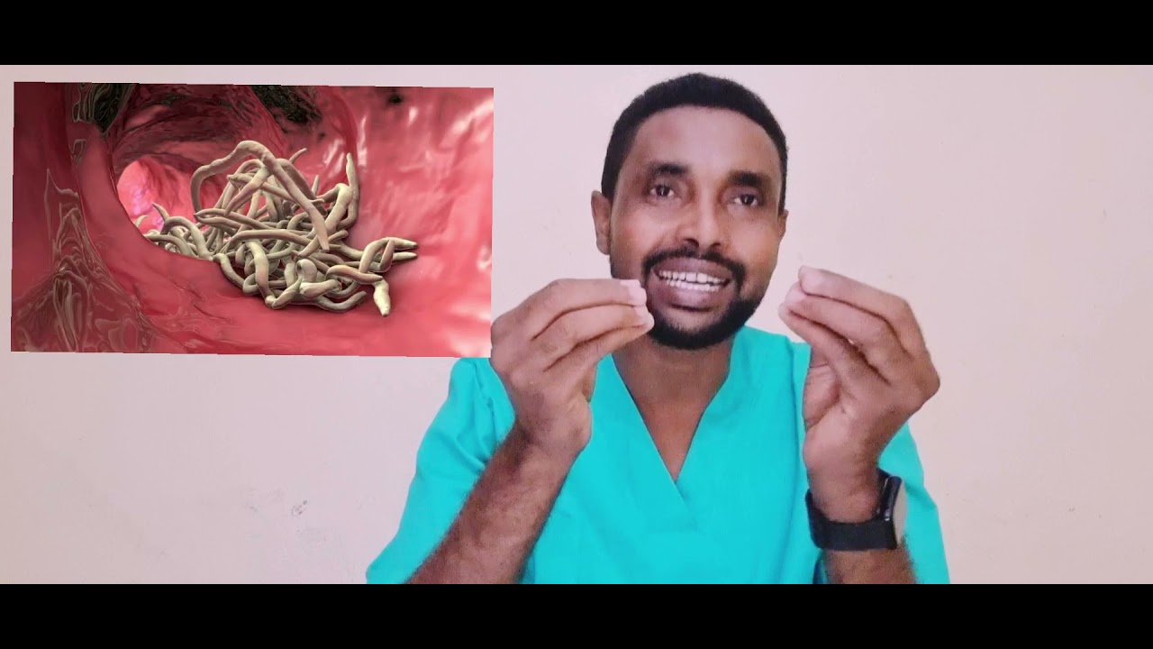 Gooryaanka ciyaalka  sidee loo daweyaa ??? Dr Cadceed