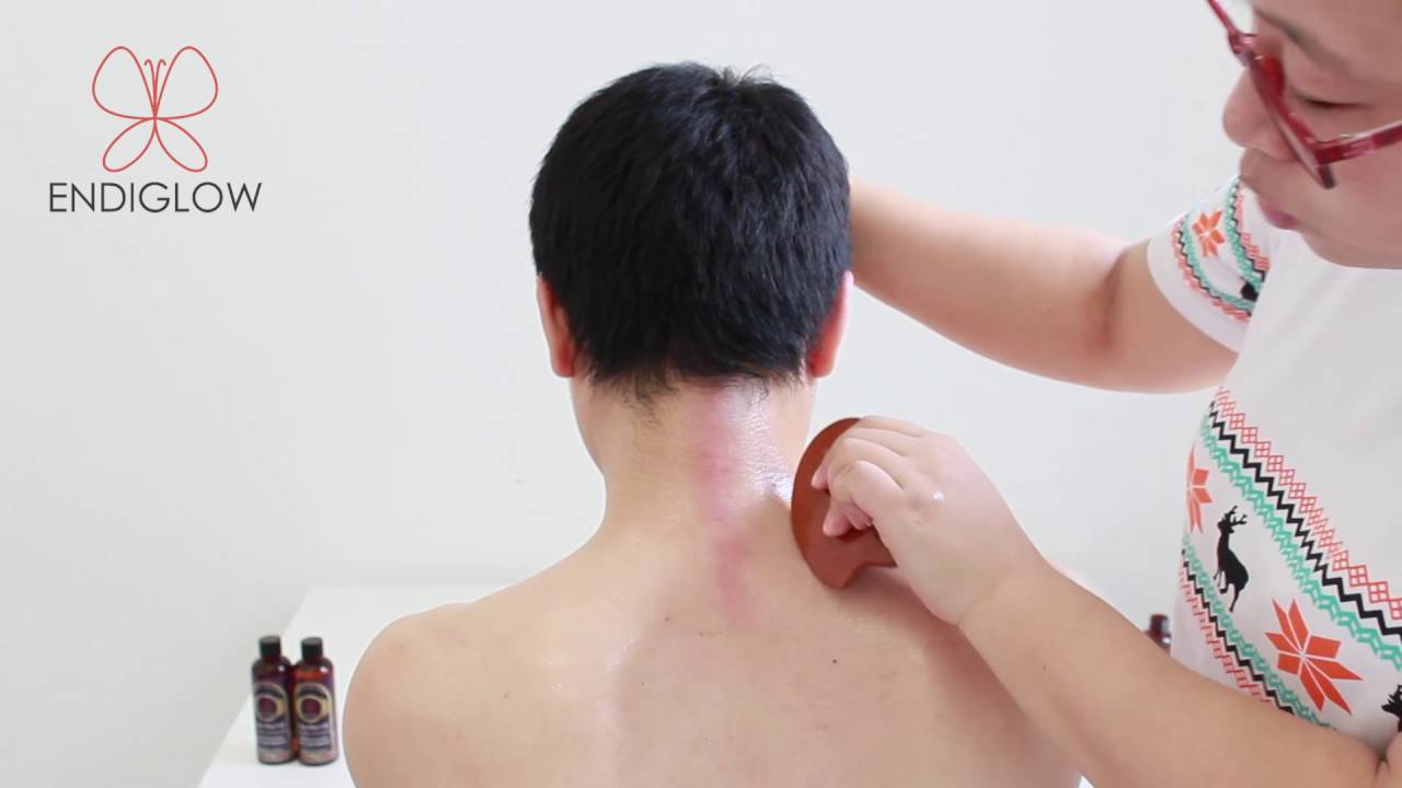 Gua Sha for reduce neck pain --scraping neck