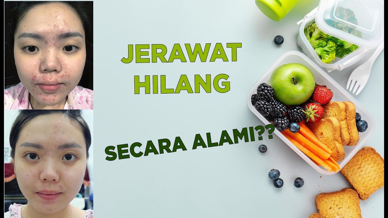 MY CLEAR SKIN DIET MENU | CUMA MAKAN INI WAKTU JERAWATAN