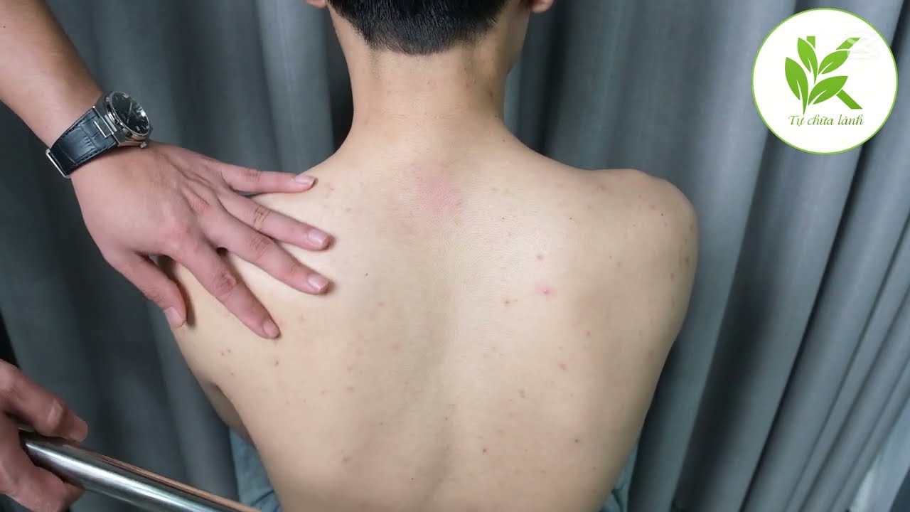 CƠ THỂ SẼ ẤM LÊN Khi Làm Theo Cách Này Cảm Cúm Phong Hàn Sẽ Lùi Xa | TCL