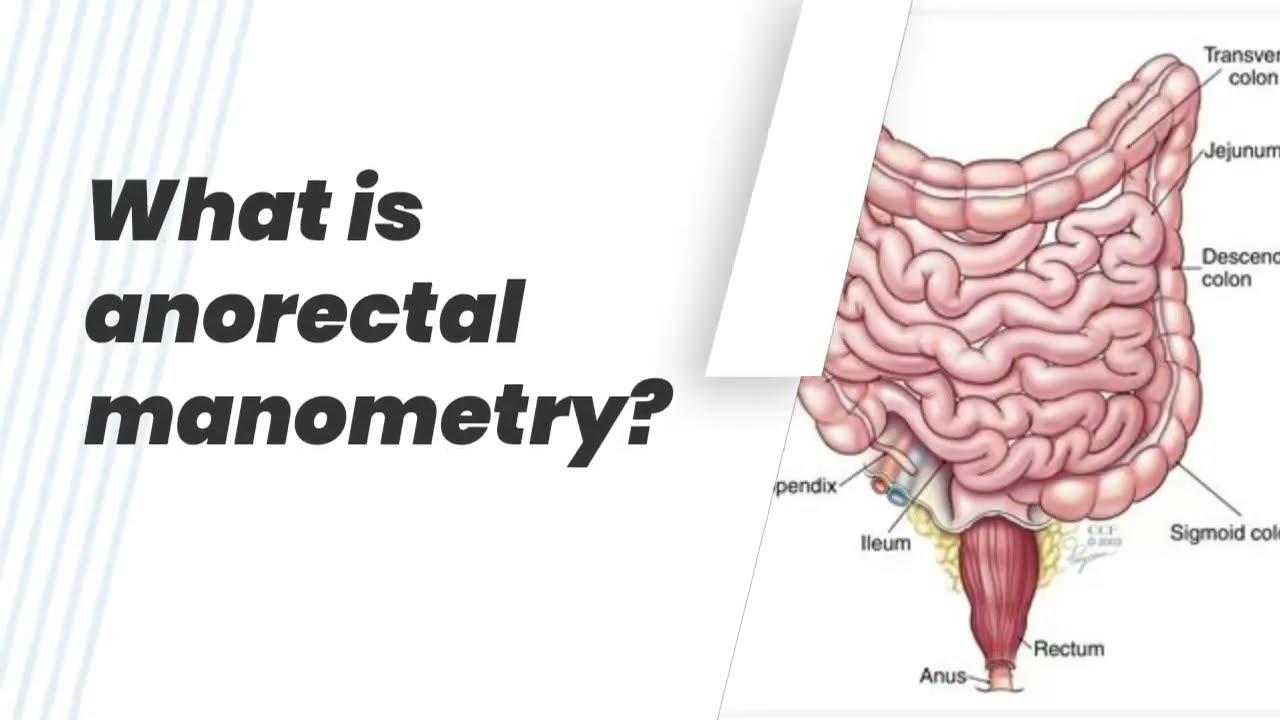 What is anorectal manometry?