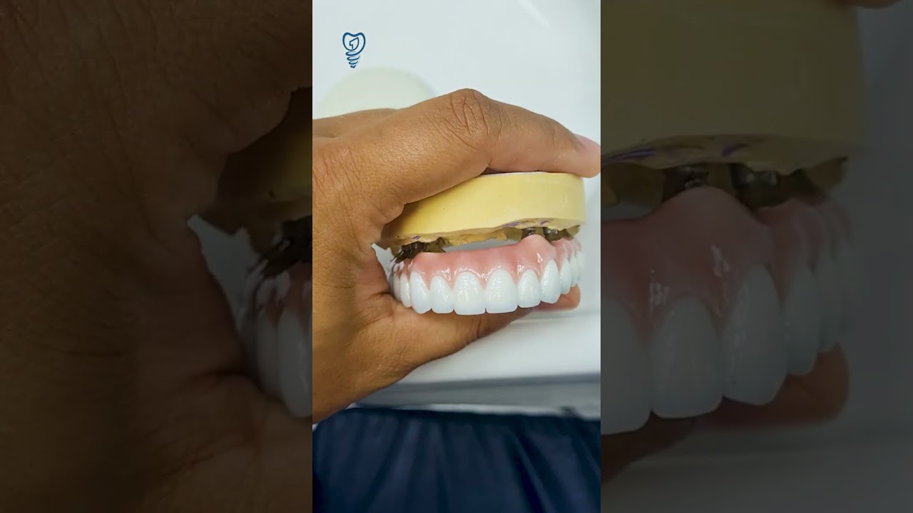 Самые белые зубы в мире. Имплантация зубов. The whitest teeth in the world. Dental implantation.