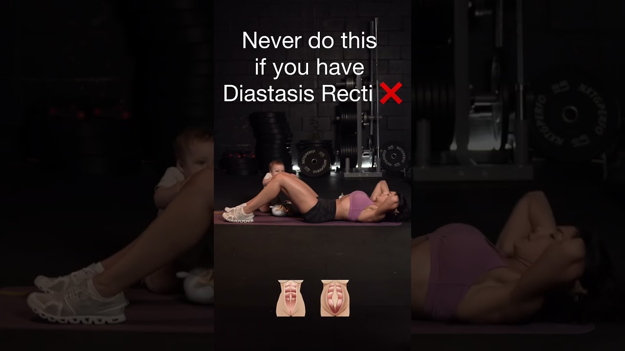 Diastasis Recti Exercises: What&rsquo;s Safe ✅and What&rsquo;s Not ❌🤰