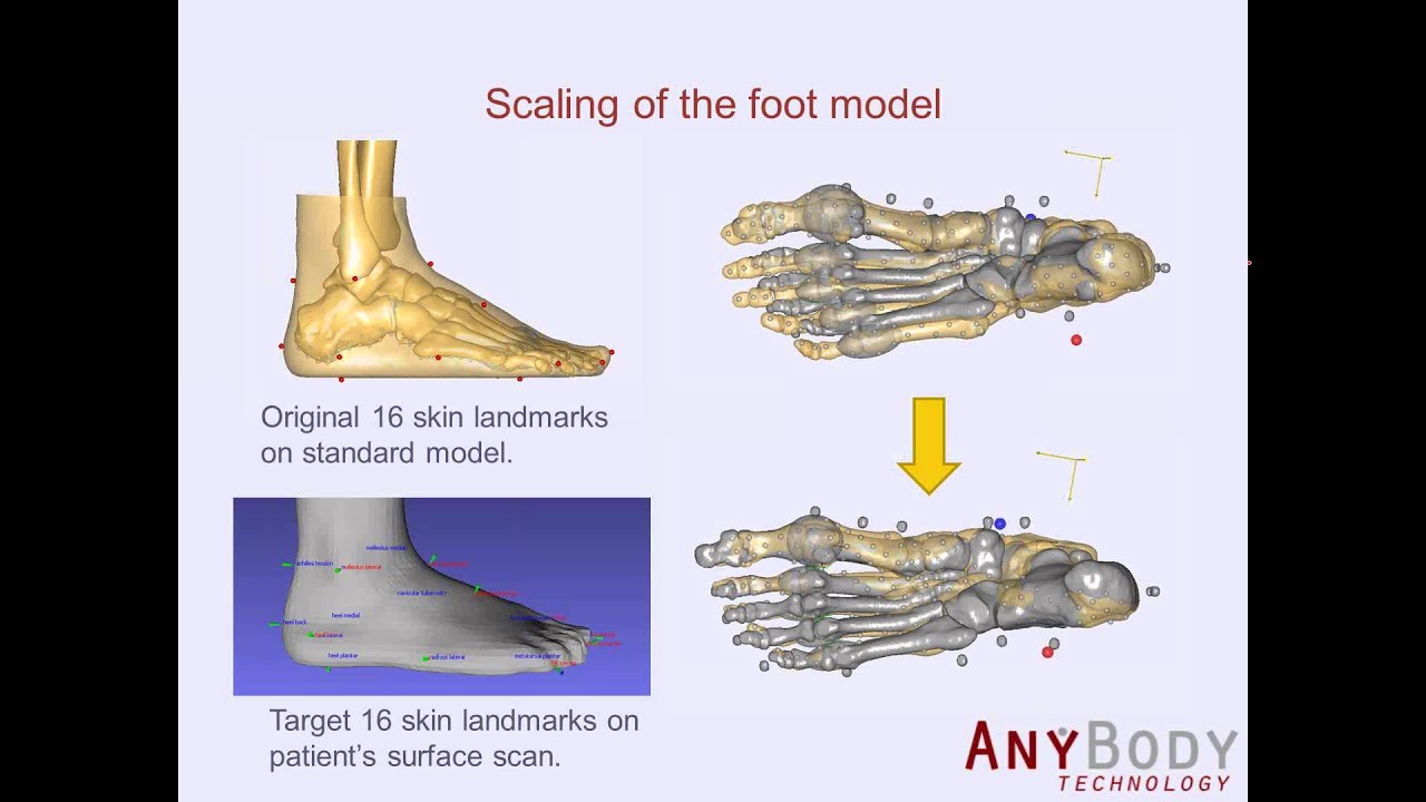 [Webcast] The new Glasgow-Maastricht AnyBody foot model