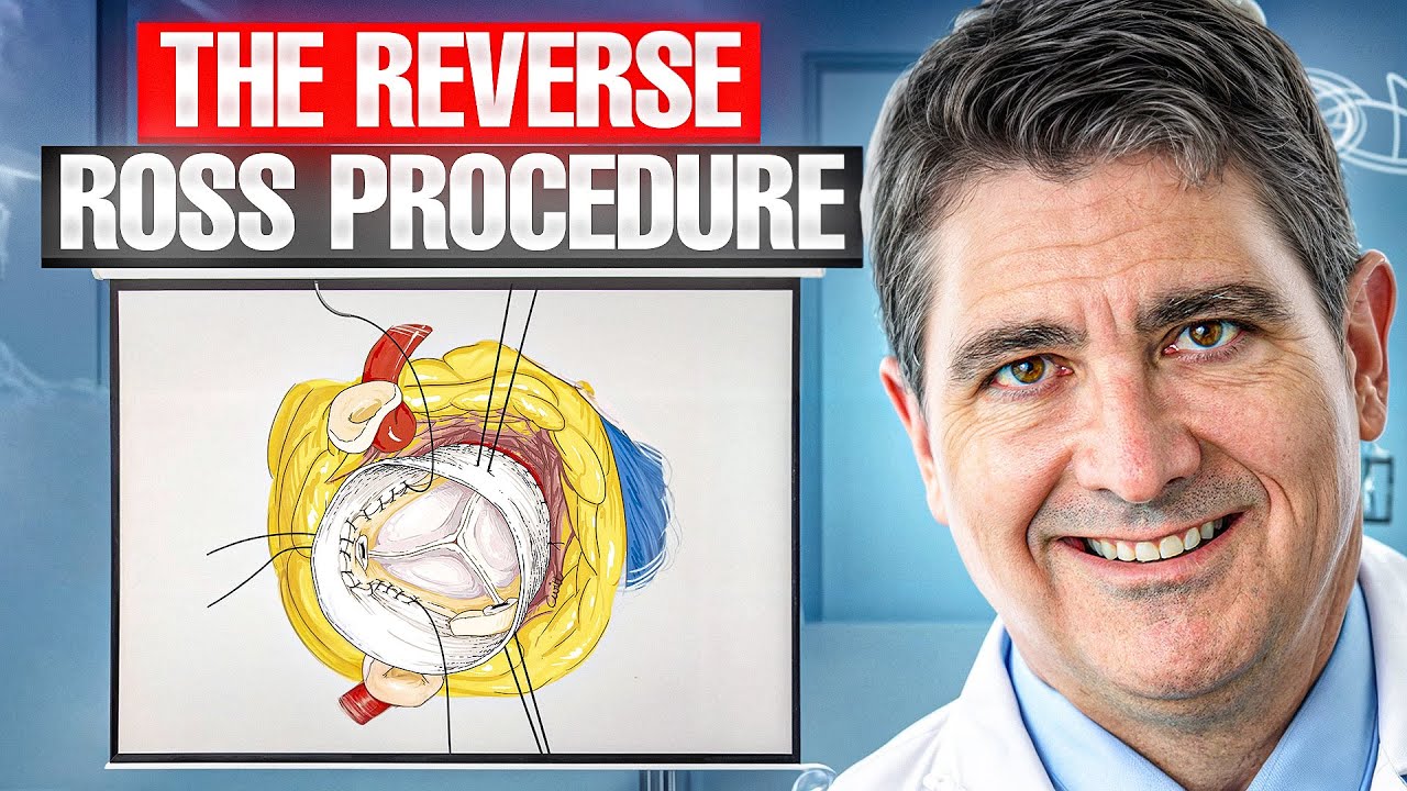 Cardiac Innovation: The Reverse Ross Procedure