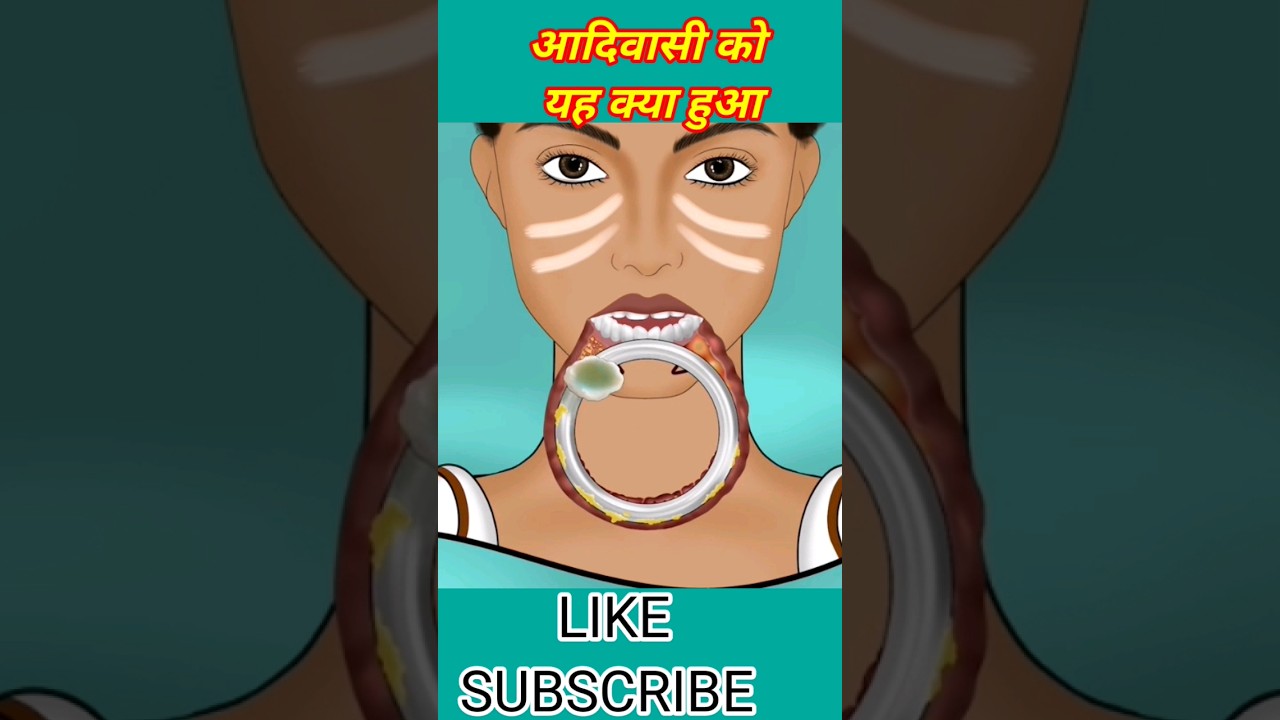 डॉक्टर आदिवासिका मु कैसे ठीक करता है| 3d animation | 3d animation ParmarRB | asmr mackup