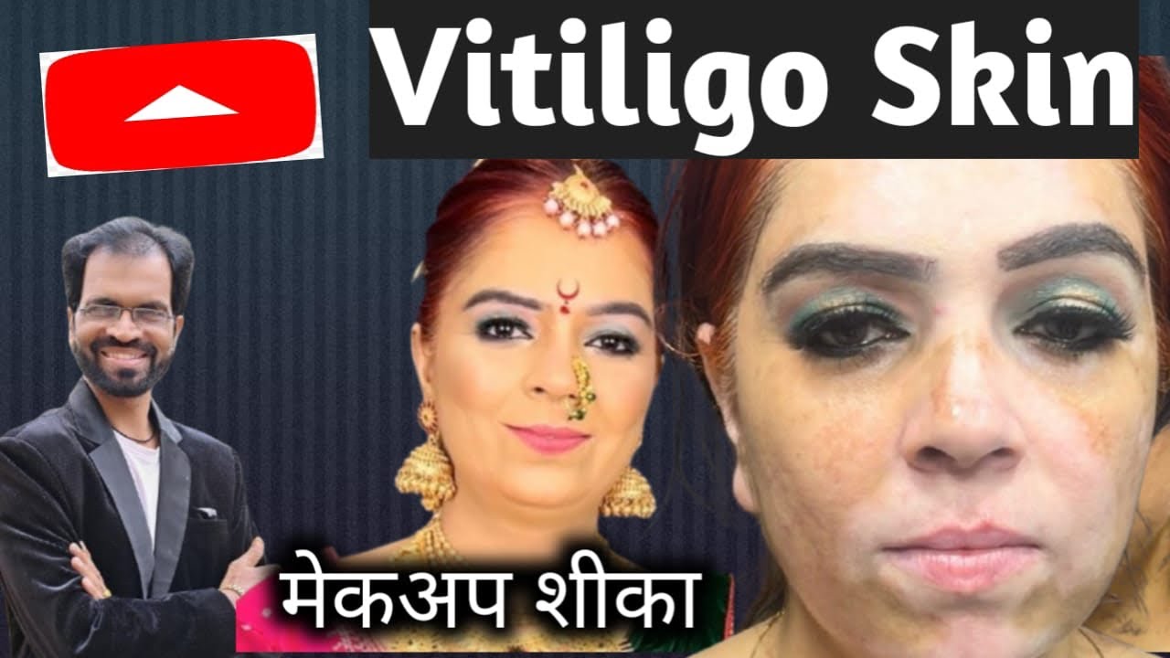 कोड असलेली स्कीन मेकअप | Vitiligo Makeup#youtube #makeup #makeuptutorial #bridelmakup #shortvideo 