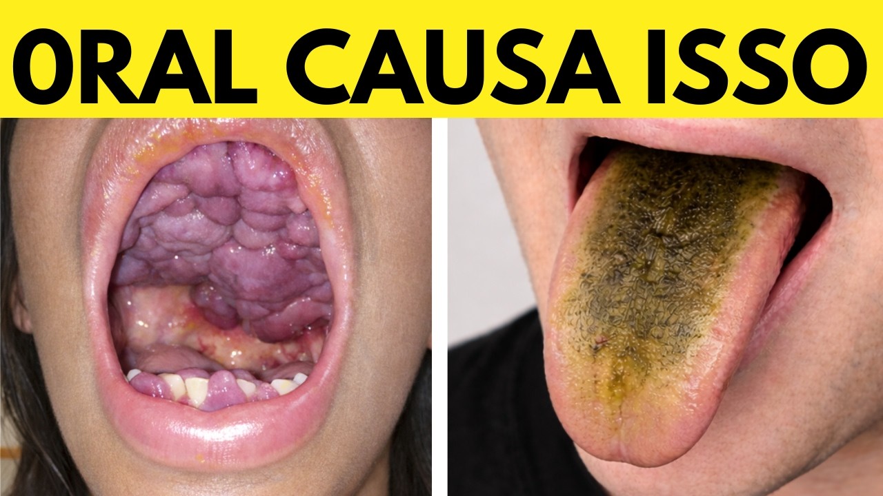 Os PERIGOS do ORAL que estão acabando com sua SAÚDE