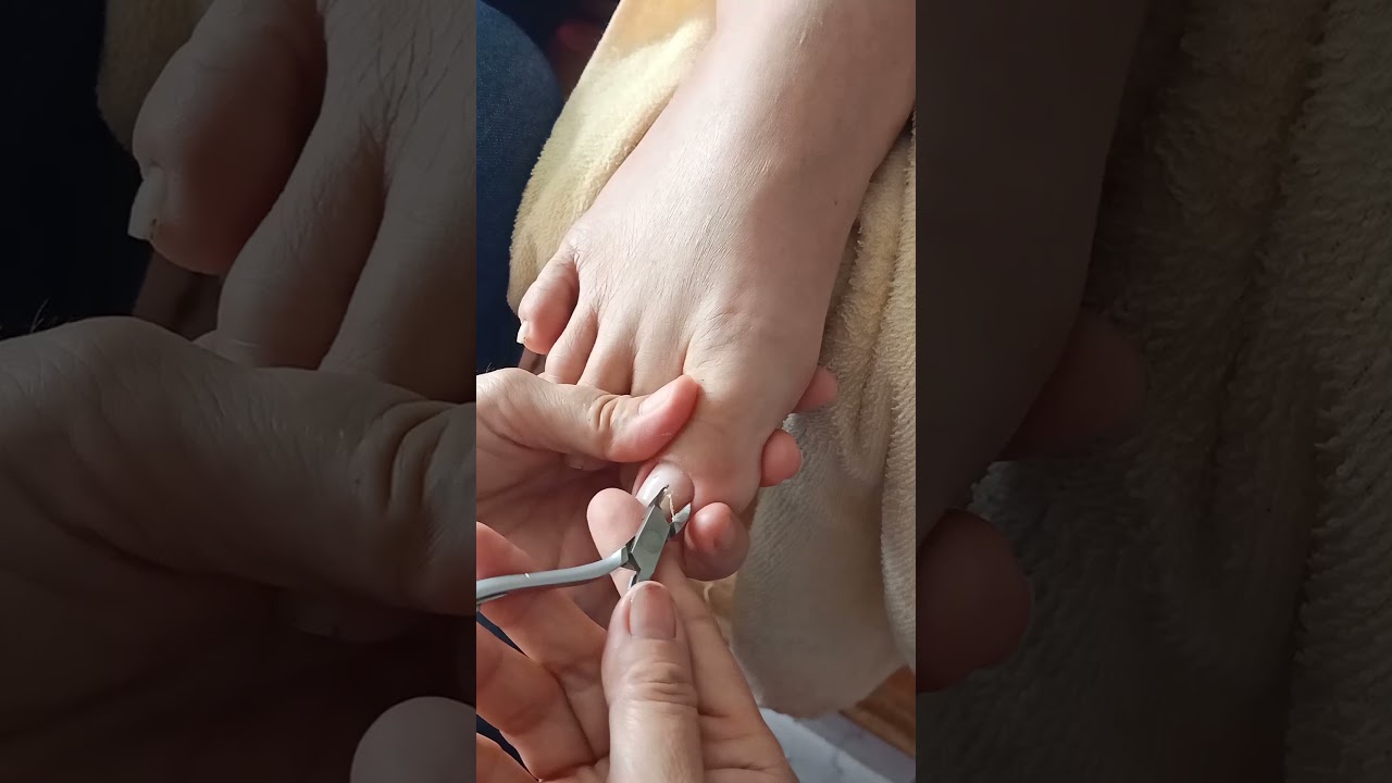 cắt da chuyên nghiệp và siêu sạch.