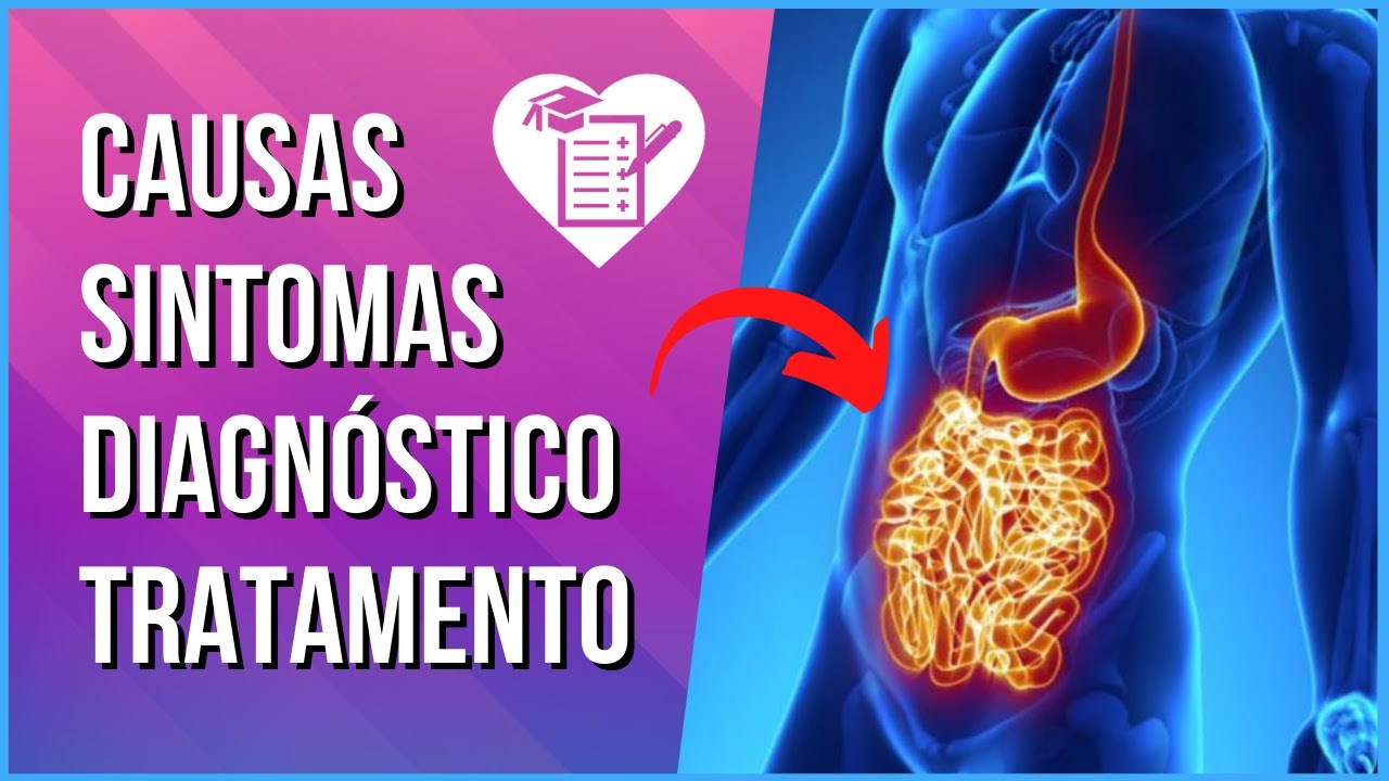 DOEN&Ccedil;A DE CROHN - Causas, Sintomas e Tratamento