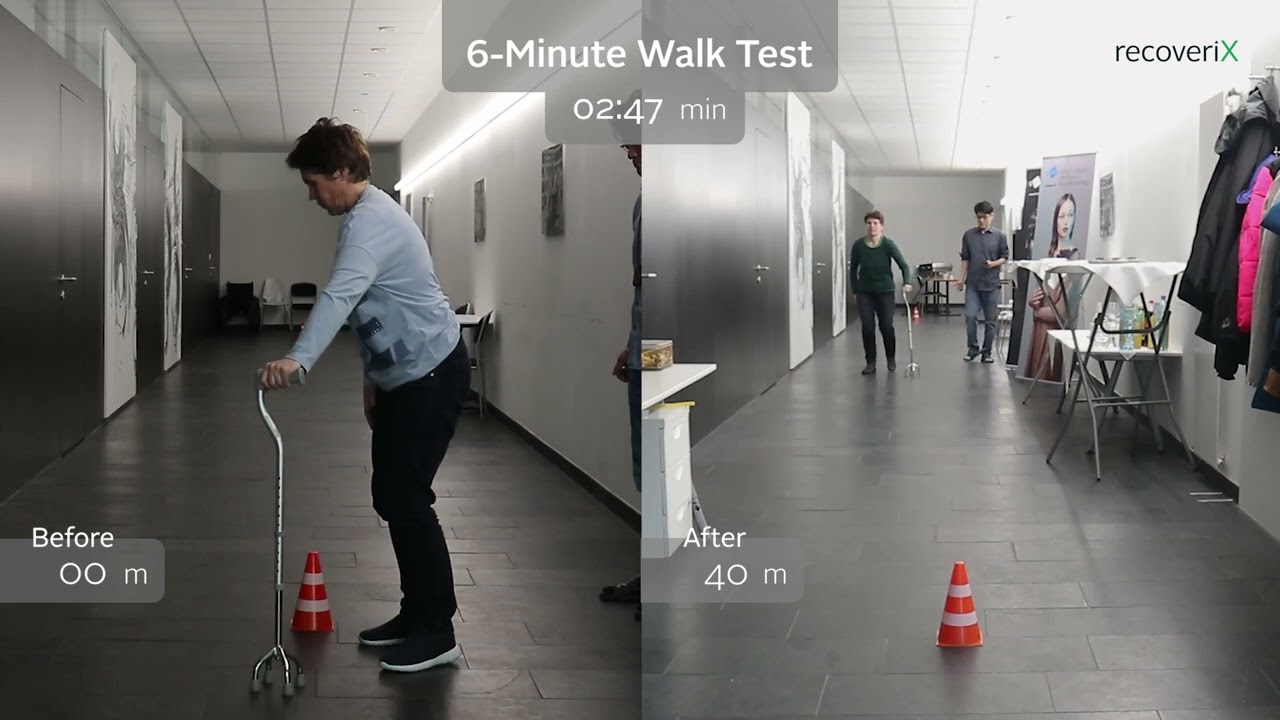 recoveriX Neurorehabilitation for Multiple Sclersosis - 6 Minute Walk Before/After Video (Patient B)