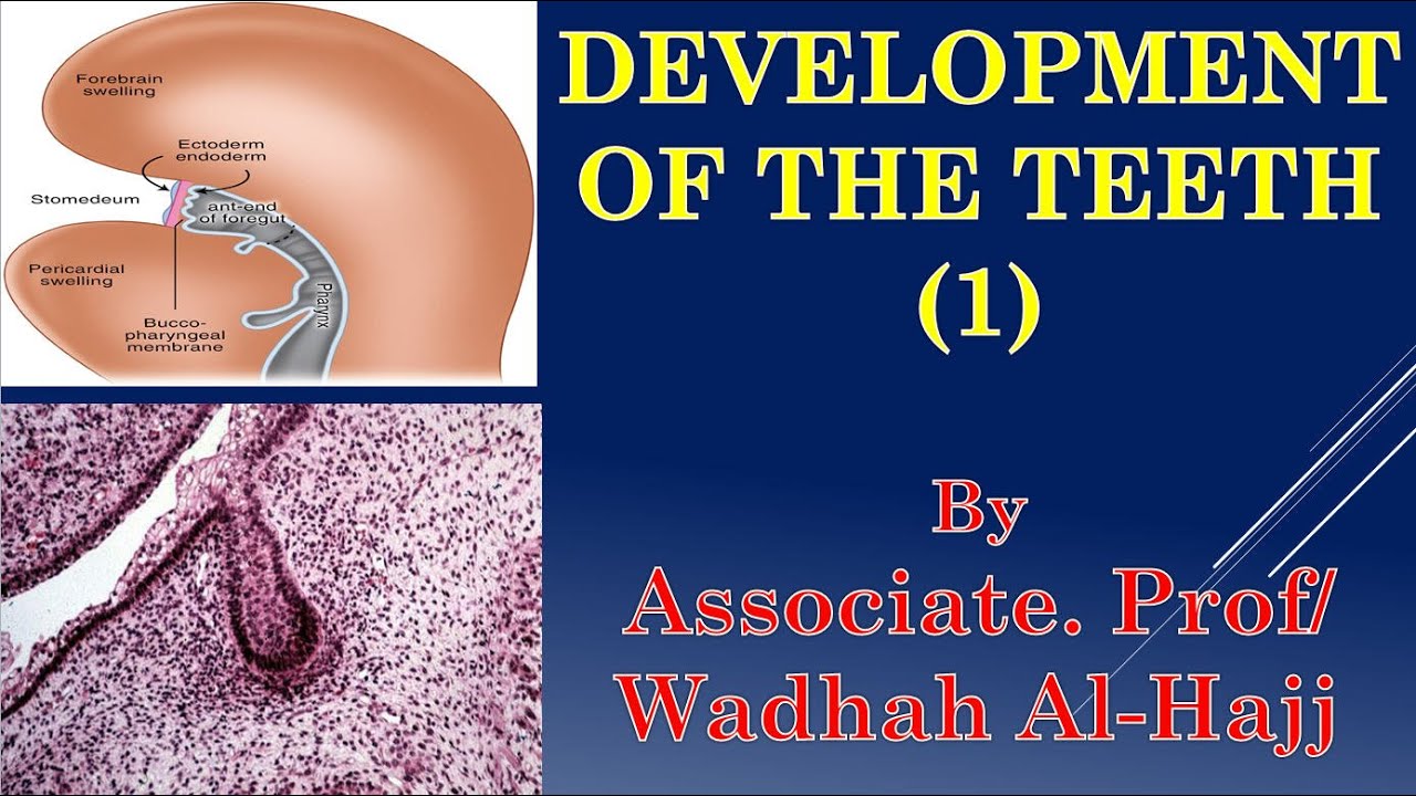4- Development of teeth (1) – Dr Wadhah embryology lectures.  د/ وضاح الحاج