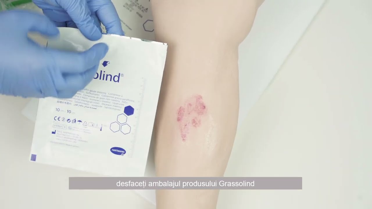 13 Cum pansam o arsura casnica de mici dimensiuni?