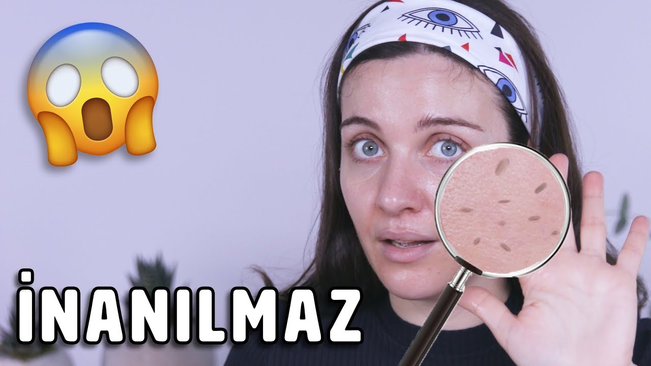 ANINDA CİLDİ SOYAN PEELİNG! 🤯😲