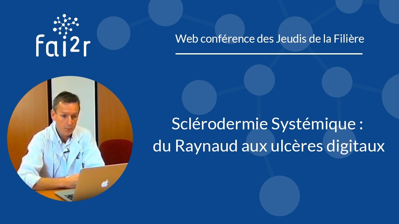 Sclérodermie systémique : du Raynaud aux ulcères digitaux