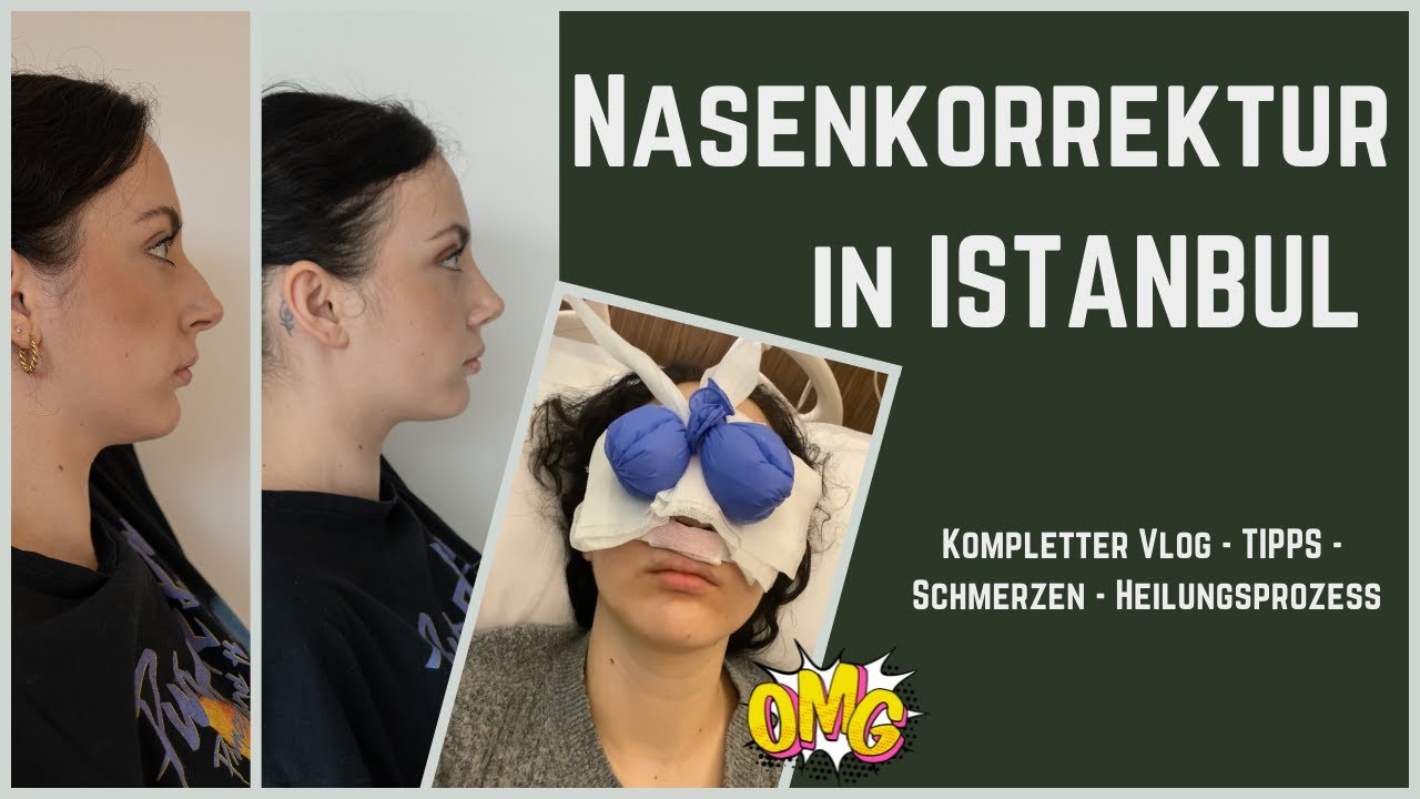 Meine Nasen OP in Istanbul   I VLOG I ABLAUF I TIPPS I SCHMERZEN I tamaraydn