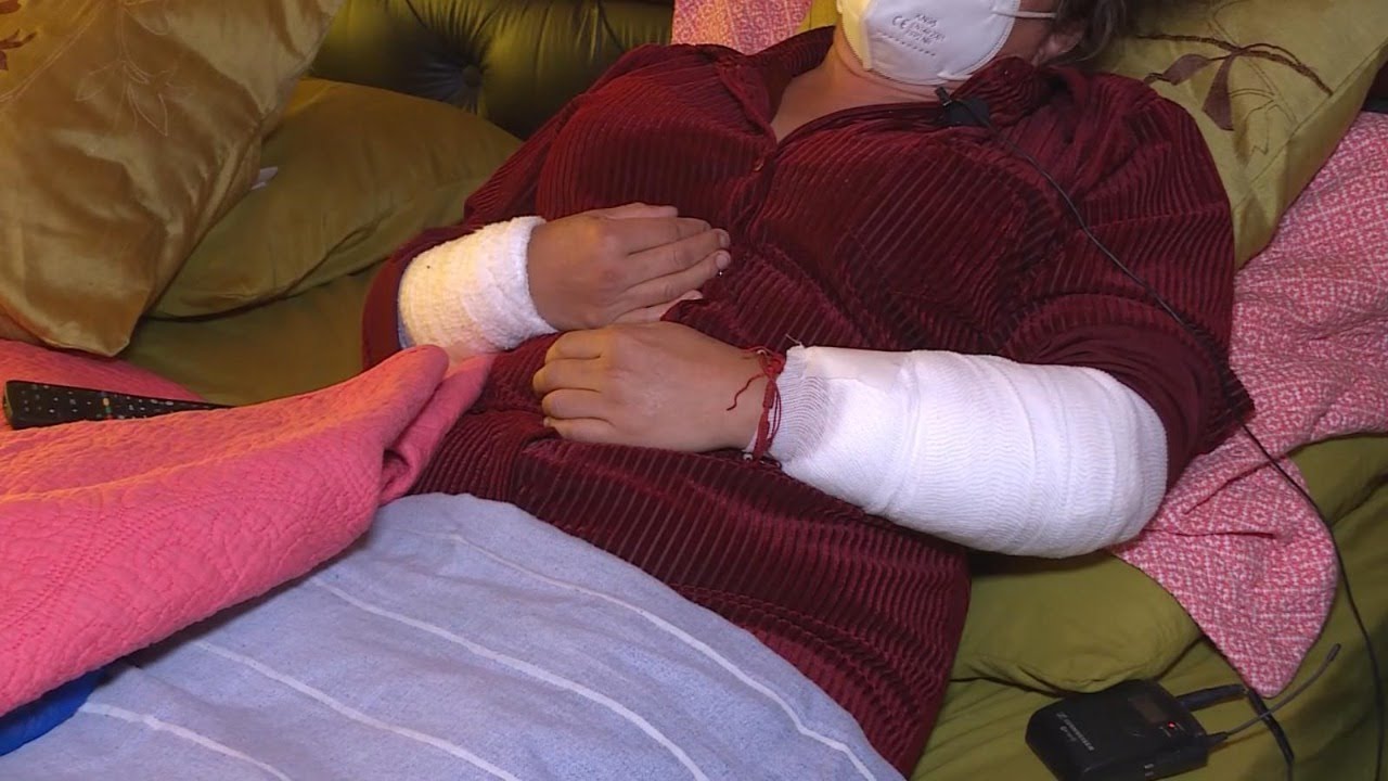 Mujer gravemente herida tras ser atacada por dos perros en Copiapó