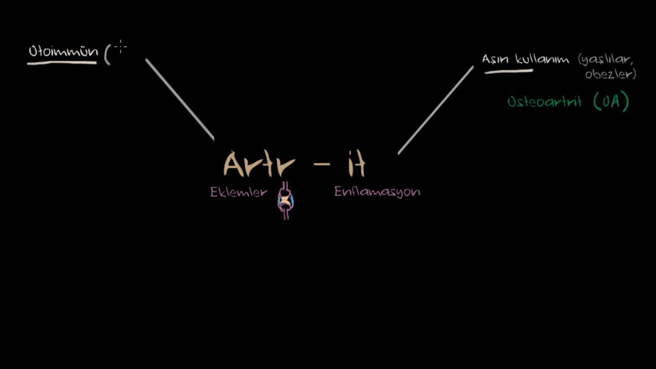 Artrit Nedir? (Fen Bilimleri) (Sağlık ve Tıp)
