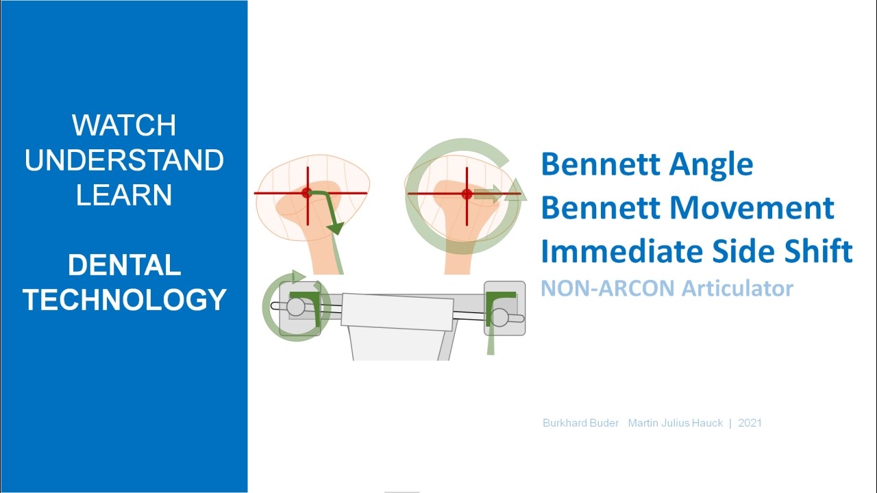 BENNETT  |  Movement  - Angle - Immediate Side Shift