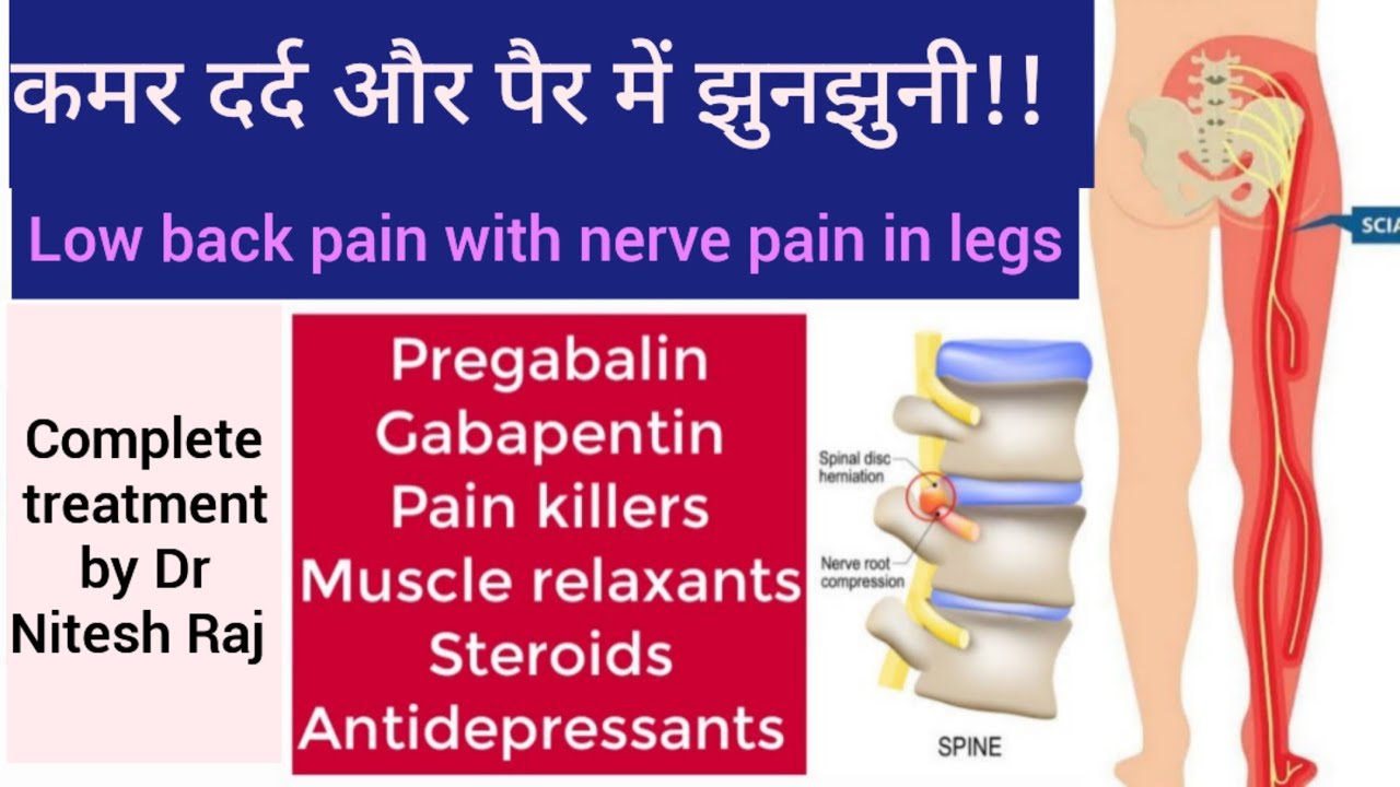 SCIATICA ka ilaz in hindi by #drniteshraj.Full information on SCIATICA symptoms,causes and treatment